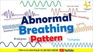 ABNORMAL BREATHING PATTERN  Apnea  Bradypnea  Tachypnea  Ataxic  Sighing  CheyneStokes [upl. by Demmahum]