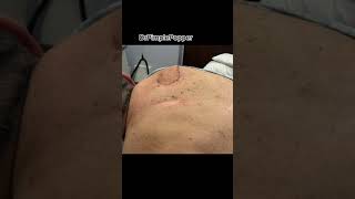 What Would You Rate My Technique Dr Pimple Popper shorts [upl. by Phares]