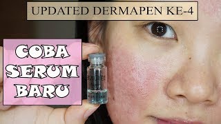 UPDATED DERMAPEN COBA SERUM BEAUTEE NANO SCAR SERUM YANG KATANYA BAGUS UNTUK ACNE SCAR DAN DERMAPEN [upl. by Nurat]