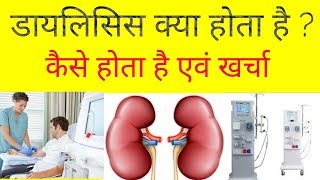 Dialysis in hindi  what is hemodialysis  dialysis kaise hota hai [upl. by Nilya]