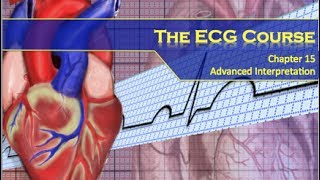 Th ECG Course  Advanced Findings [upl. by Sukhum]