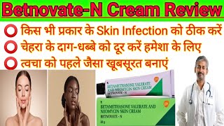 BetnovateN। BetnovateN Skin cream review 2023। How to uses betnovate n skin cream on face। [upl. by Niroht]