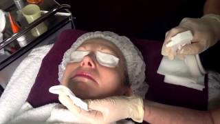 NeoStrata Glycolic Skin Peel  Outline Clinic Droitwich Worcestershire UK [upl. by Oiliduab]