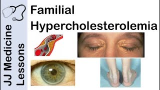 Familial Hypercholesterolemia  Genetics Pathophysiology Symptoms and Treatment [upl. by Clarkin]