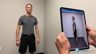 PostureScreen Augmented Reality Assisted Automatic Posture Assessments [upl. by Uos]