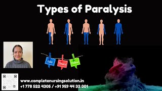 Types of Paralysis amp Its Nursing care nclex nclexpracticequestions paralysis paralysistreatment [upl. by Nonnek]