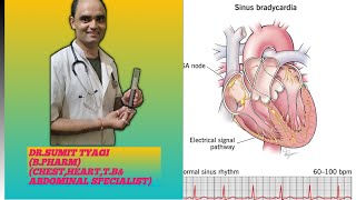 SINUS ARRTHMIA BRADICARDIA amp TRACHECARDIA BY DRSUMIT TYAGISUMITMEDICALDISPENSARY1 [upl. by Perot]