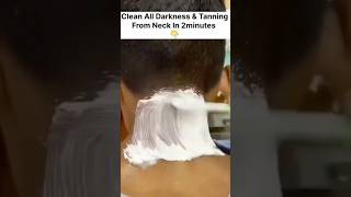 Dark Neck Home Remedies  Neck Cleaning Tips  Easy Neck Tanning Removal Pack [upl. by Omixam]