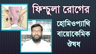 ফিস্টুলা রোগ কি এর হোমিওপ্যাথি ও বায়োকেমিক চিকিৎসা  fistula homeopathy treatment in bangla [upl. by Farl]