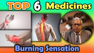 Top 6  Homeopathy Medicines for Burning Sensation  Dr PS Tiwari [upl. by Colbye368]