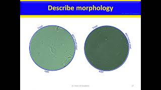 Giardia lamblia Giardia intestinalis Giardia doudenalis version 2 [upl. by Noivaz]