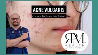 Acne vulgariscausesfeatures and treatment RPM HEALTH LEARNING ACADEMY by rpmhealthclinic [upl. by Pet]