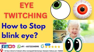 How to Stop EYE twitchingwhat cause twitching eyelidHow get rid of twitching eyelidstop blink eye [upl. by Ricard]