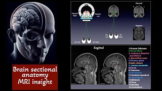 Brain Sectional anatomy on MRI Basa ganglia Caudate nucleus Putamen Globus pallidus [upl. by Anaderol]