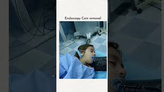 Endoscopy coin removel [upl. by Atnima]