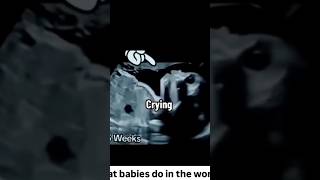 👼👼👼What Babies Do In The Womb 👼👼👼shortvideo baby [upl. by Gierc]