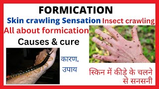 FormicationInsect crawling sensation on skinCause amp Cureस्किन पर कीड़े का रेंगना कारण और ईलाज [upl. by Madonna910]