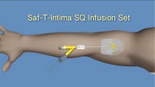 How to Insert SafTIntima™ SQ Infusion Set [upl. by Hook]