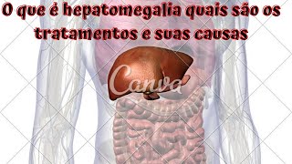 O que é hepatomegalia quais são os tratamentos e suas causas [upl. by Cleary480]