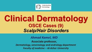 Clinical Dermatology OSCE Cases 9 Scalp amp Hair Disorders [upl. by Inafit]