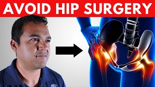 You CAN Avoid Hip Joint Replacement Surgery [upl. by Ziguard]