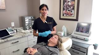 Ultherapy Treatment with Before and After Results  Dr Shalini Gupta [upl. by Nrehtak]