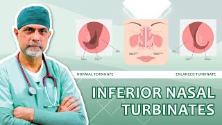 Inferior Nasal Turbinates Function Issues and Treatments Explained Dr Major Rajesh Bhardwaj [upl. by Boucher39]