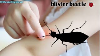 Blister beetle 🐞BhawaniSinghRawat blisterbittleblisterbittlebulbulfafola bhringbhrings [upl. by Ahsenre216]