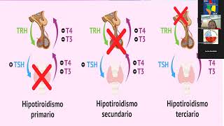 Video 6º Módulo ENDOCRINOLOGÍA Patología Tiroidea  Curso NOA 2024 [upl. by Filbert]
