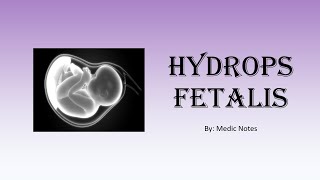 Hydrops fetalis  causes investigation management prognosis [upl. by Noffets635]