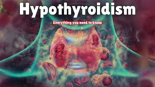 Hypothyroidism  Symptoms Causes Treatment amp Medication [upl. by Leugim]