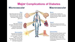 CHRONIC COMPLICATIONS OF DIABETES MELLITUS AND ITS PATHOGENESIS [upl. by Einaffit]