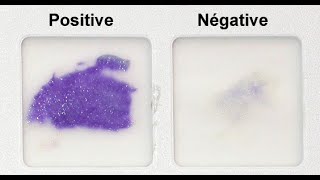 Oxidase Test Practical Tutorial [upl. by Aguste]