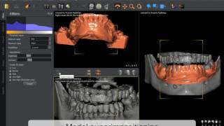 QuickVision 3D  Superimpositioning  OWANDY RADIOLOGY [upl. by Adnal17]