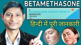 betamethasone valerate cream ip  betamethasone dipropionate cream  betnovate cream ke fayde [upl. by Ellekim]