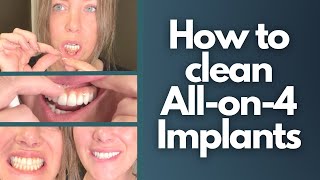 How to clean Allon4 Implants [upl. by Adnaral]