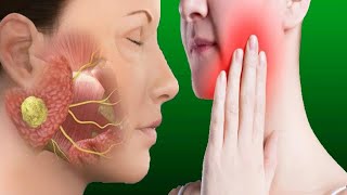 Salivary Gland Infection Causes And Treatment [upl. by Wiese]