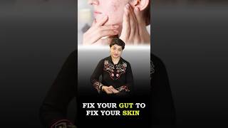 The Link Between Digestive Health amp Clear Skin Connection Between Acne Gut Health amp Skin Problems [upl. by Dedric]