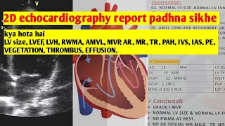 2D echocardiography ki report padhna sikhe [upl. by Pricilla]