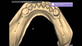 Exocad Exoplan 3Shape InLab Cerec millbox [upl. by Ariaic]