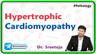 9 Hypertrophic Cardiomyopathy Pathology USMLE Step 1 [upl. by Einapets]