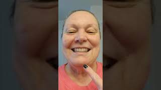 Healing on day 30 after a 21 day 5 Fluorouracil treatment for Basal Cell Carcinoma 2222023 [upl. by Rogovy]