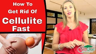 How to Get Rid of Cellulite  7 Tips for Curing Cellulite  VitaLife Show Episode 149 [upl. by Timmi463]