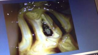 Oroscopic examination of the molar arcades teeth in a horse occlusal surface [upl. by Noived]