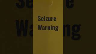 Flashing lights can cause seizures facts [upl. by Butcher]