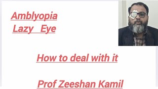 lazyeyeamblyopiaeyecareeyetreatmentdoctordrzeeshankamil [upl. by Griffith]