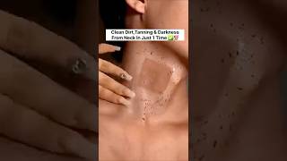 Neck Cleaning Tips  Dark Neck Home Remedies Tanning Removal Tips😲 beautyskincare rshortsviral [upl. by Eliath]