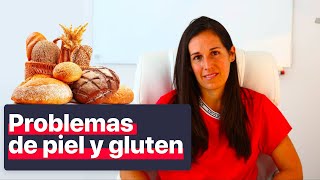 Problemas de piel y su relación con el gluten [upl. by Murrah498]