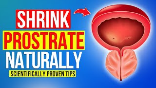 Beat BPH Naturally Proven Remedies for Prostate Health 🌿✅” [upl. by Gorman]