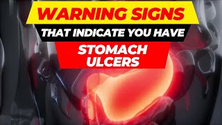 top 10 warning signs of stomach ulcers [upl. by Berkman]